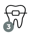 03-ortodoncia