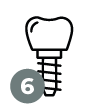 06-implantologia